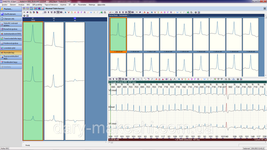 Система холтерівського моніторування ЕКГ ECGpro Holter (версія Lite) ECGpro-Holter_Lite фото