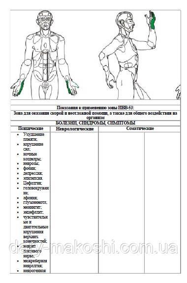 Атлас зон та Методичні рекомендації для апаратів ІХТ "Поріг" и ІХТ "Колбун", pdf 133стор. ІХТ-Поріг фото