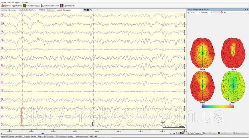 ПЗ "NeuroEEG" ЕЕГ для "BrainBit", енцефалограф 4-х канальний NeuroEEG еег фото