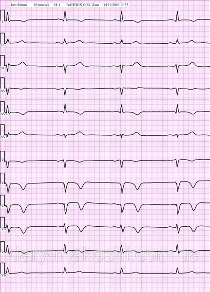Діагностичний комплекс ЕКГ «Cardio» 12 каналів екг, ЭКГ, кардіограф фото