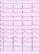 Диагностический комплекс ЭКГ «Cardio» 12 каналов екг, ЭКГ, кардіограф фото 8