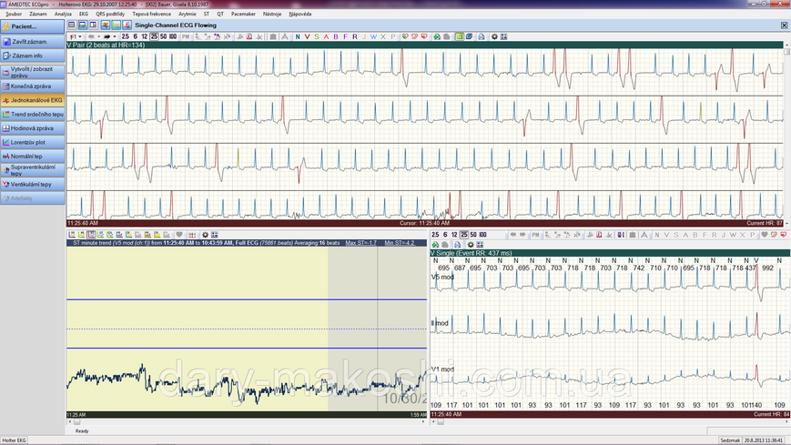 Система холтерівського моніторування ЕКГ ECGpro Holter (версія S) ECGpro-Holter_S фото
